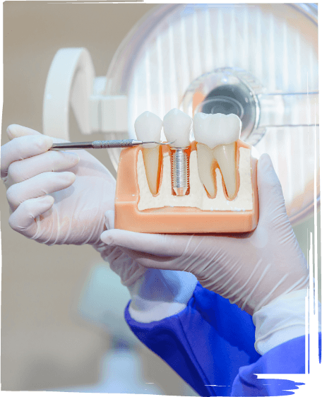 Dentist holding a dental implant model