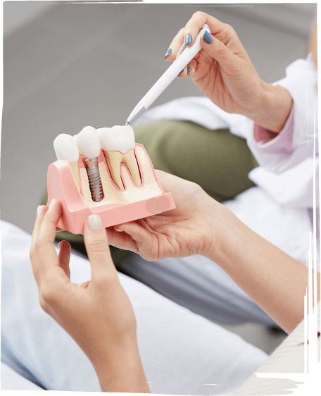 Dentist showing a dental implant model to a patient