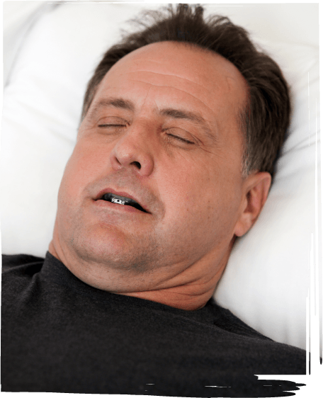Man sleeping while wearing nightguard over his teeth