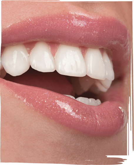 Close up of smile with flawless straight white teeth